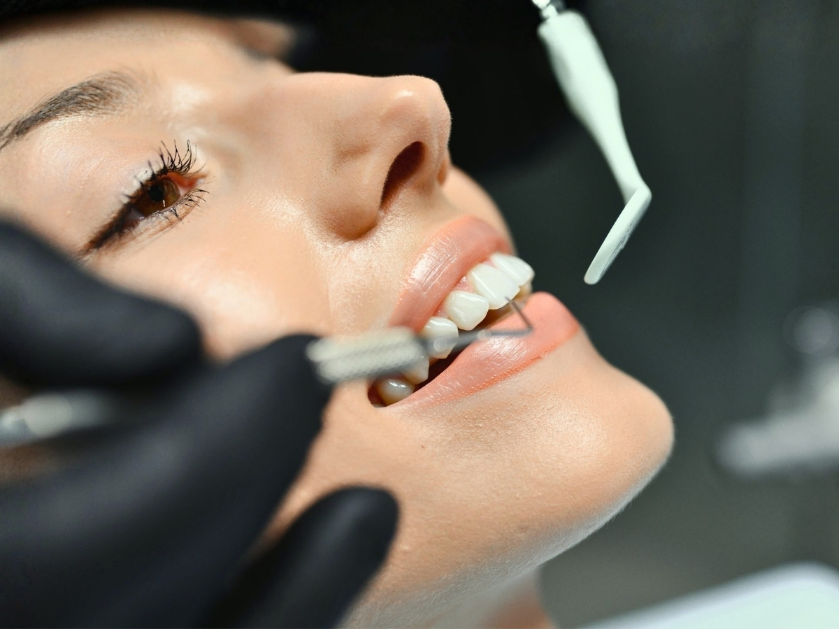 Endodoncija — lečenje kanala korena zuba